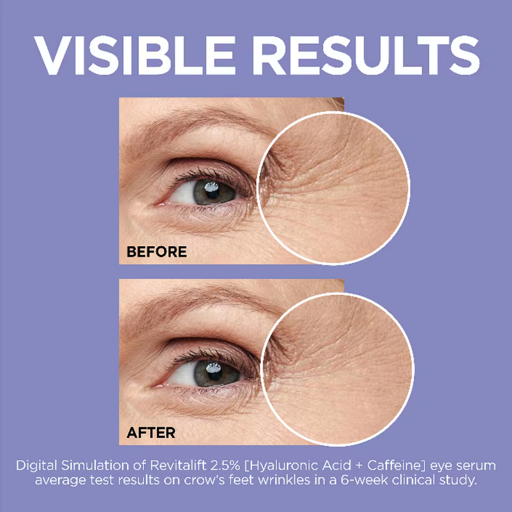 Revitalift 2.5% Hyaluronic Acid + Caffeine Under Eye Serum | L'Oréal Paris