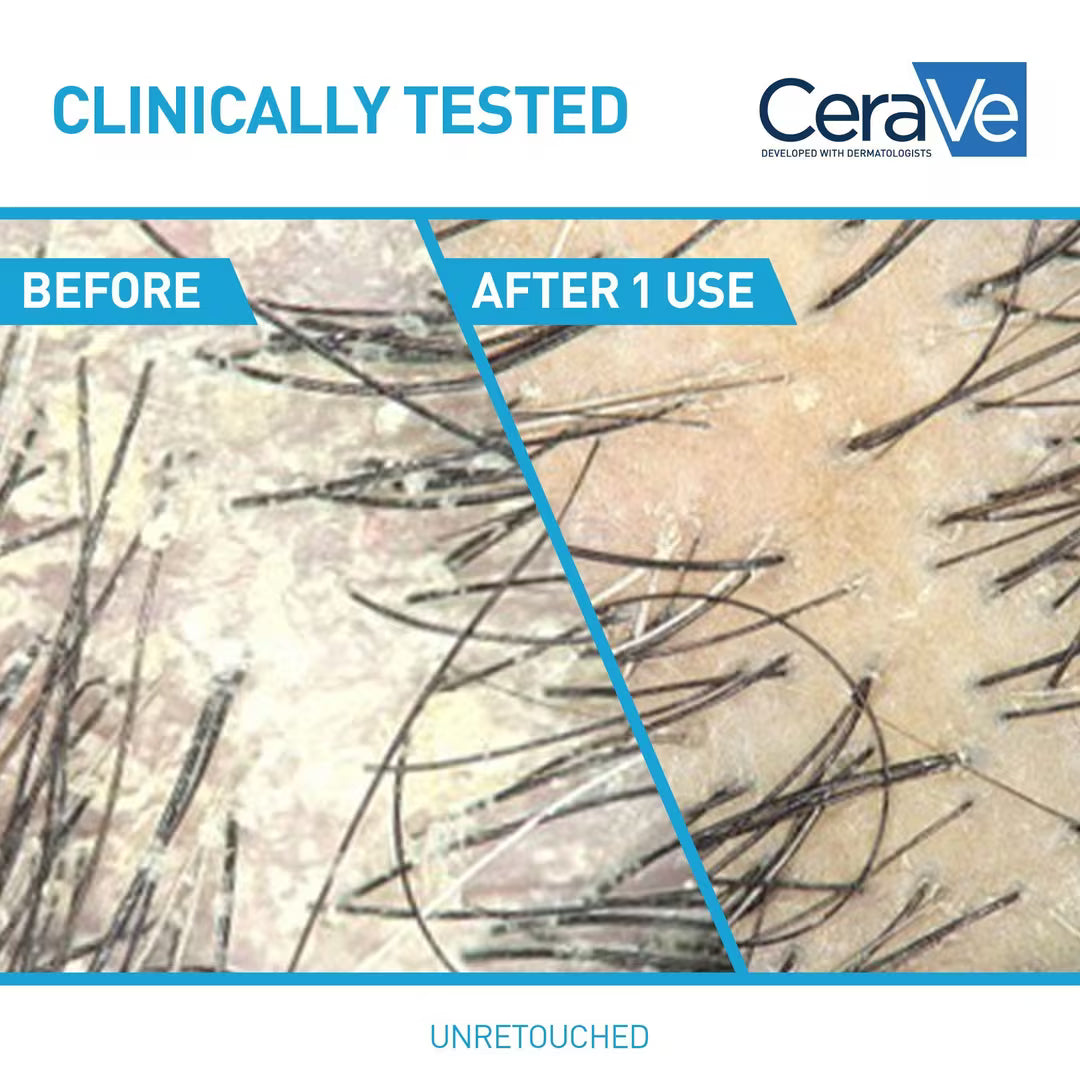 Anti-Dandruff Hydrating Shampoo | CeraVe