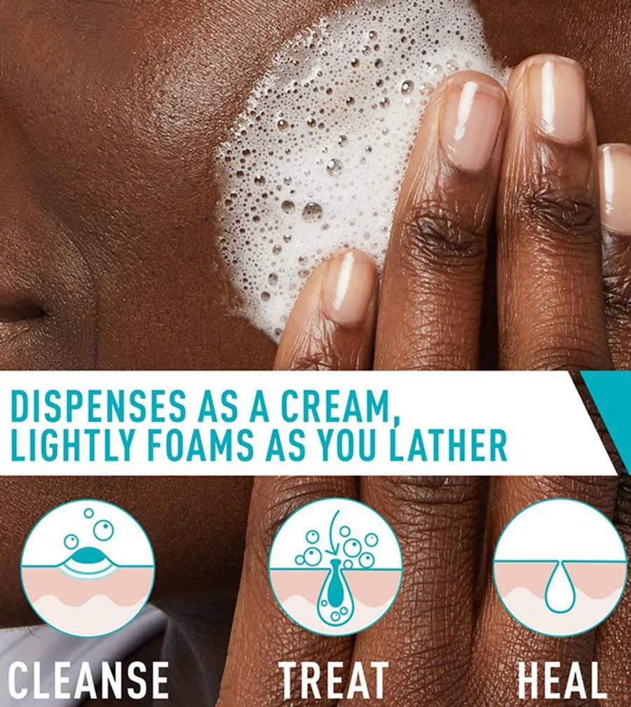 Acne Foaming Cream Cleanser | CeraVe