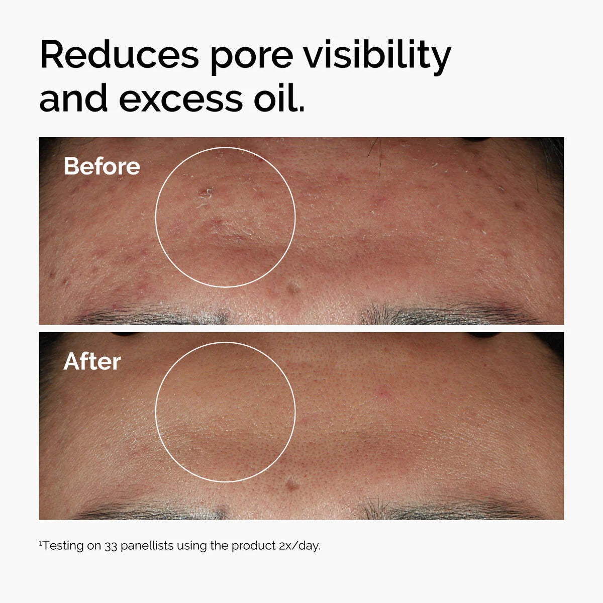 Niacinamide 10% + Zinc 1% 30 ml | The Ordinary
