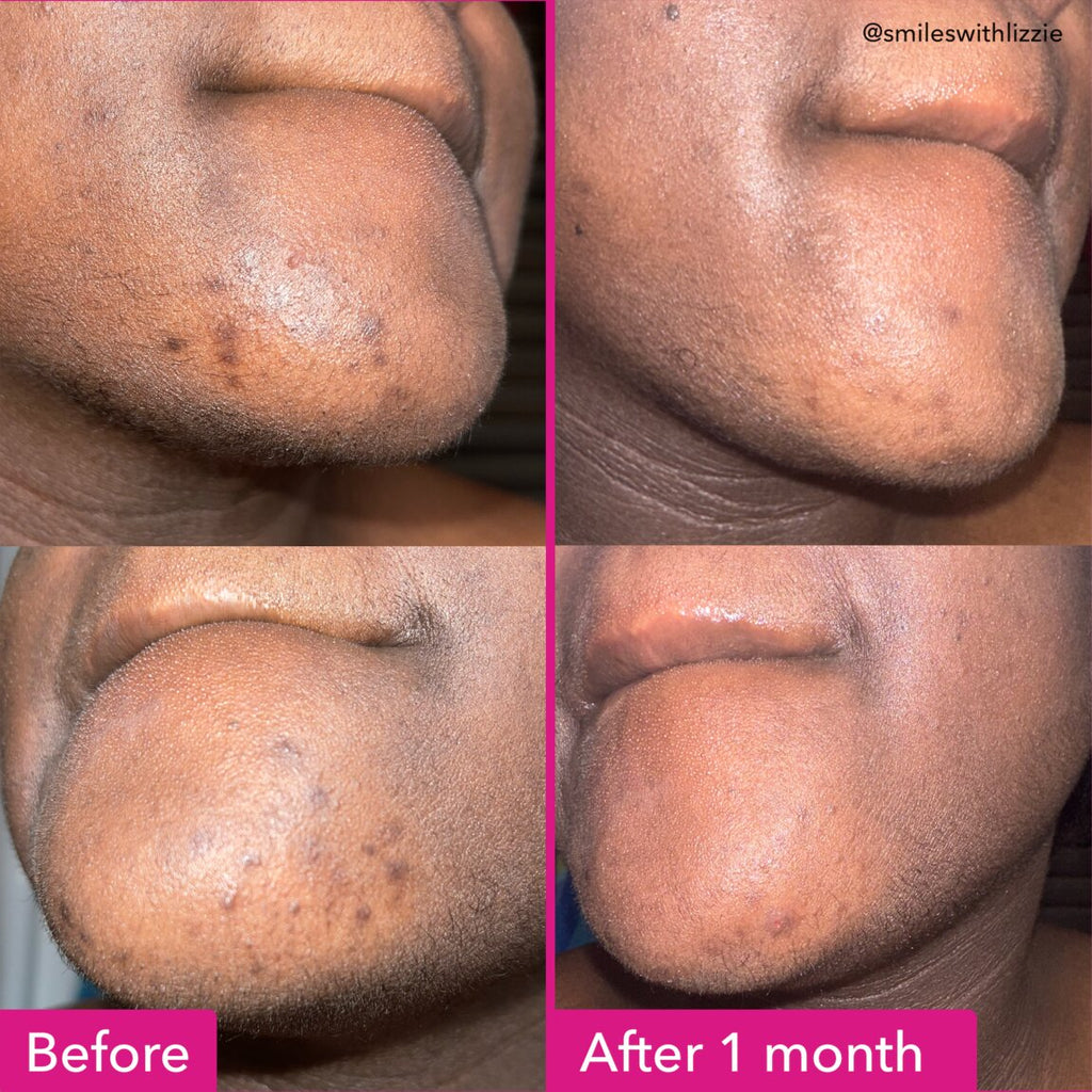 Brightening & Dark Spots Bar | Good Molecules
