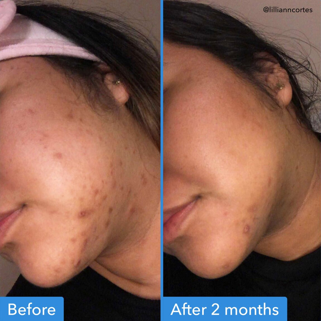 Discoloration Correcting Serum 30ml | Good Molecules